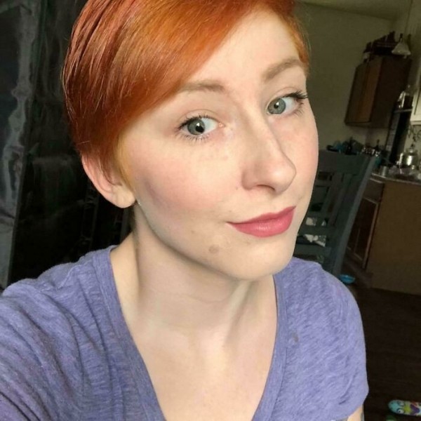 На этих фото показали, какие финты генетика вытворяет с людьми На этих фото показали, какие финты генетика вытворяет с людьми