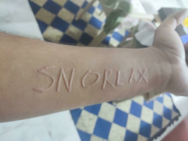 На этих фото показали, какие финты генетика вытворяет с людьми На этих фото показали, какие финты генетика вытворяет с людьми