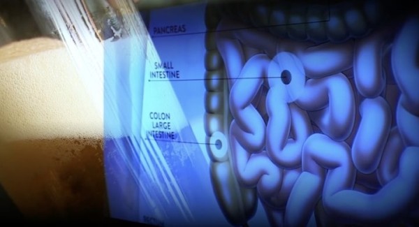 Редкий случай: организм мужчины стал сам вырабатывать спирт