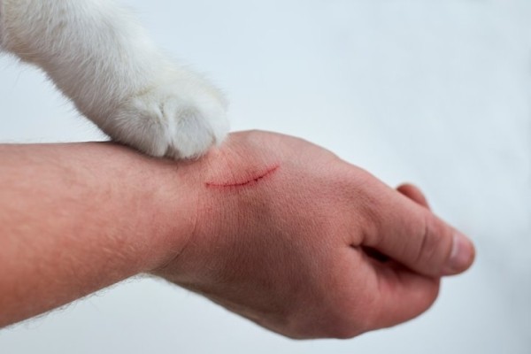 Болезнь кошачьих царапин: чем вас может заразить пушистый любимец Болезнь кошачьих царапин: чем вас может заразить пушистый любимец