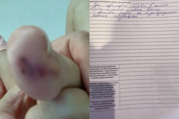 Во время примерки сапог девушка наткнулась на гвоздь Во время примерки сапог девушка наткнулась на гвоздь