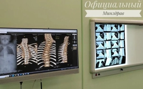 В Беларуси сделали операцию ребенку с врожденной аномалией позвоночника В Беларуси сделали операцию ребенку с врожденной аномалией позвоночника