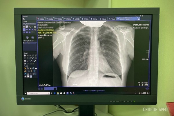 Брест – снижение стоимости на рентген и МРТ! Брест – снижение стоимости на рентген и МРТ!