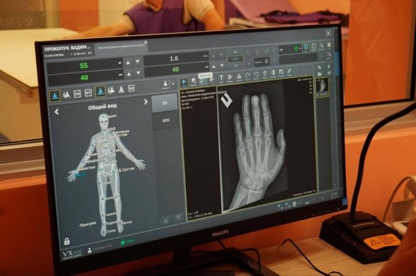 В Брестской городской поликлинике №6 улучшена доступность рентгенологических исследований В Брестской городской поликлинике №6 улучшена доступность рентгенологических исследований