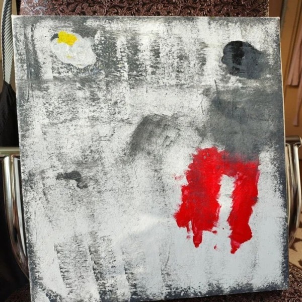 Женщина из Брестской области в 32 года потеряла зрение Женщина из Брестской области в 32 года потеряла зрение