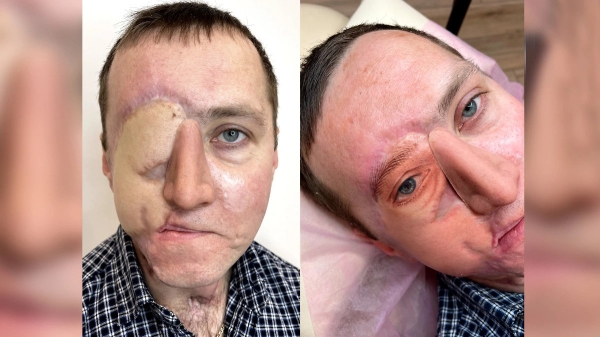 «Я набиваю людям реалистичные пупки, соски и глаза». Белорусская тату-мастер делает то, что не могут хирурги «Я набиваю людям реалистичные пупки, соски и глаза». Белорусская тату-мастер делает то, что не могут хирурги