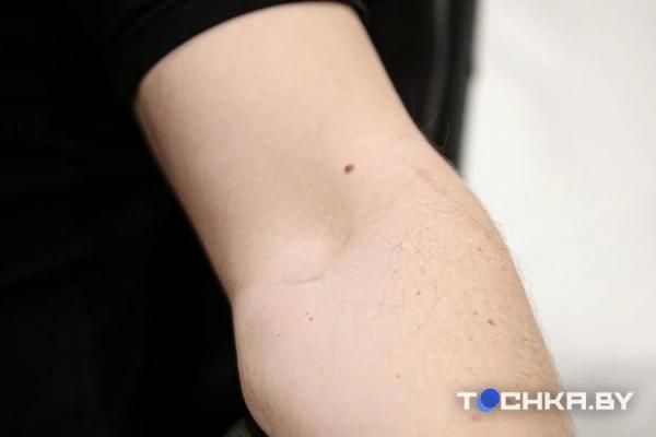 Исповедь бывшего наркомана из Беларуси Исповедь бывшего наркомана из Беларуси