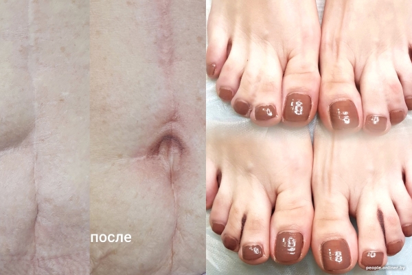 «Я набиваю людям реалистичные пупки, соски и глаза». Белорусская тату-мастер делает то, что не могут хирурги «Я набиваю людям реалистичные пупки, соски и глаза». Белорусская тату-мастер делает то, что не могут хирурги