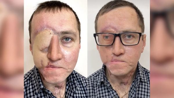 «Я набиваю людям реалистичные пупки, соски и глаза». Белорусская тату-мастер делает то, что не могут хирурги «Я набиваю людям реалистичные пупки, соски и глаза». Белорусская тату-мастер делает то, что не могут хирурги