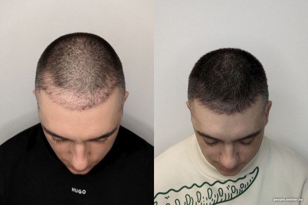 «Я набиваю людям реалистичные пупки, соски и глаза». Белорусская тату-мастер делает то, что не могут хирурги «Я набиваю людям реалистичные пупки, соски и глаза». Белорусская тату-мастер делает то, что не могут хирурги