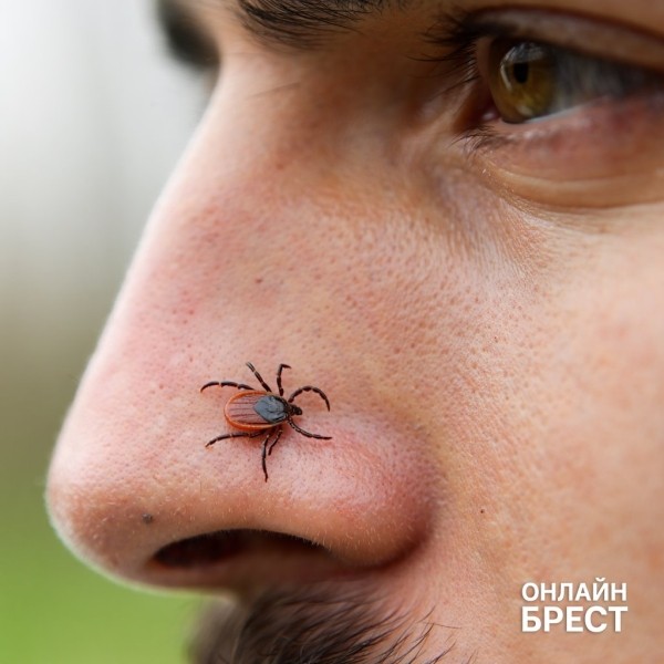 53 человека, в том числе 25 детей, пострадали от укусов клещей в Брестской области. Как защитить себя от нападения 53 человека, в том числе 25 детей, пострадали от укусов клещей в Брестской области. Как защитить себя от нападения